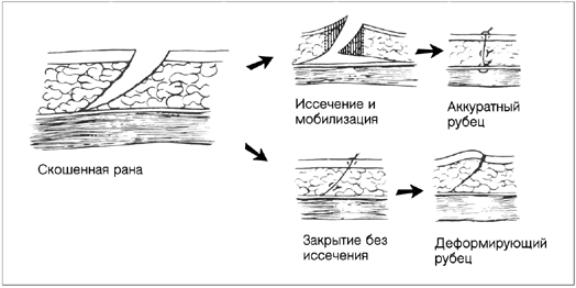 Ушивание входа во влагалище фото